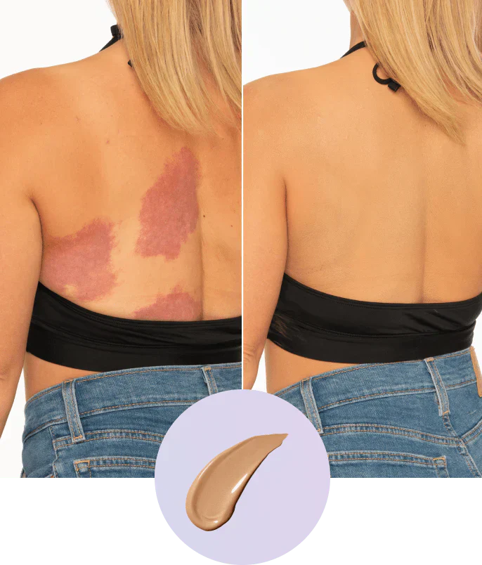 ✨Body Coverage Perfector – Waterproof, Lightweight & Flawless Body Makeup