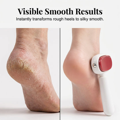 📢📢47% OFF !! ⏰Double-Sided Foot Scraper for Callus Removal